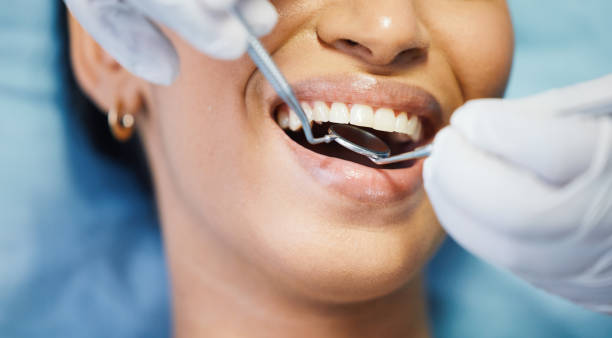 Best Knocked-Out Tooth (Avulsed Tooth) Treatment in Secy, AR