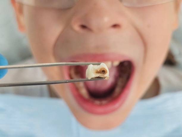 Best Emergency Care for Gum Disease in Secy, AR